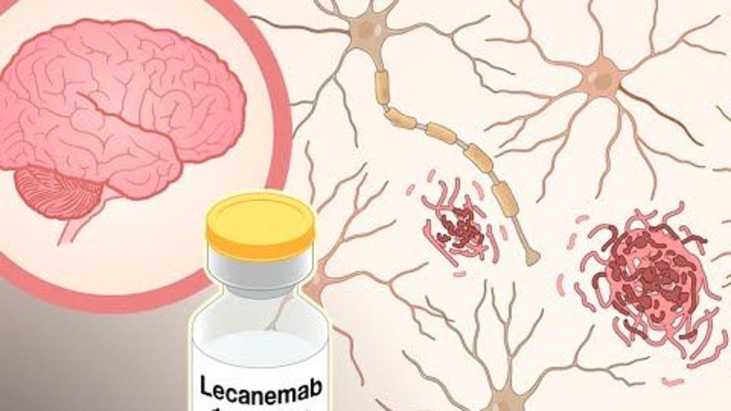 Primer fármaco contra el Alzheimer: cómo el villano se convirtió en héroe